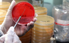 Typhoid sample on blood agar in laboratory