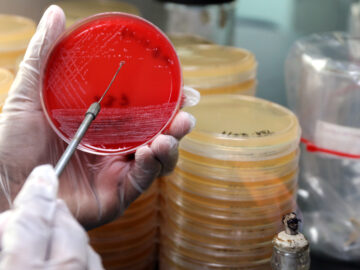 Typhoid sample on blood agar in laboratory