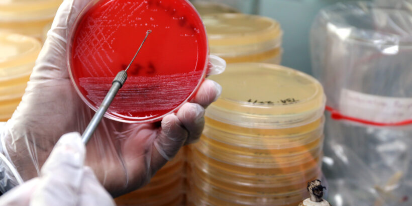 Typhoid sample on blood agar in laboratory